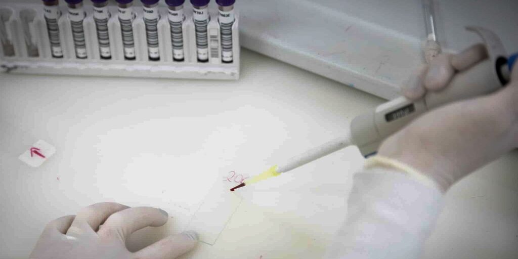 exames-descartam-ebola-em-imigrante-da-republica-democratica-do-congo